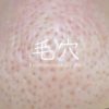 1月：きっかけは婚約破棄-毛穴の詰まりは運の詰まり-